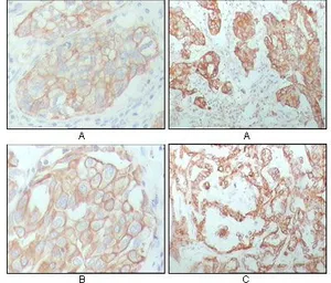 Anti-Cytokeratin 8 antibody [8A5D12] used in IHC (Paraffin sections) (IHC-P). GTX83140