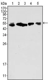 Anti-Cytokeratin 8 antibody [8A5D12] used in Western Blot (WB). GTX83140
