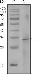 Anti-Factor VIII antibody [5E9B2] used in Western Blot (WB). GTX83141