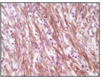 Anti-Desmin antibody [10H7D2] used in IHC (Paraffin sections) (IHC-P). GTX83146