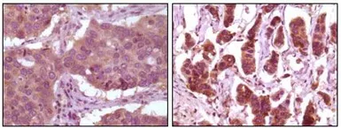 Anti-ERK2 antibody [4C11] used in IHC (Paraffin sections) (IHC-P). GTX83148