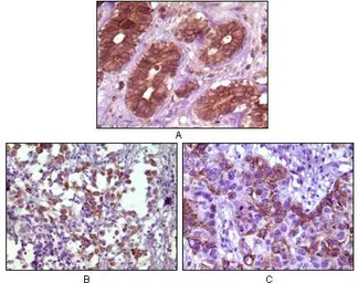 Anti-BLK antibody [9D10B7] used in IHC (Paraffin sections) (IHC-P). GTX83154