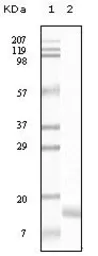 Anti-gamma Synuclein antibody [1H10D2] used in Western Blot (WB). GTX83156