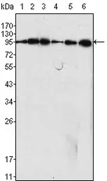 Anti-Dynamin 1 antibody [3G4B6] used in Western Blot (WB). GTX83158