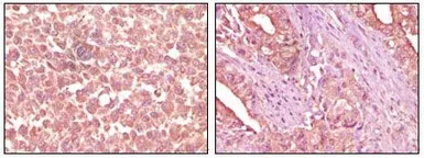 Anti-EphA2 antibody [1B3C7] used in IHC (Paraffin sections) (IHC-P). GTX83159