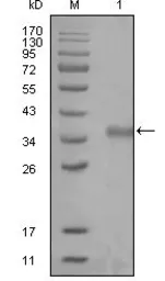 Anti-NCOR1 antibody [7A7A9] used in Western Blot (WB). GTX83168
