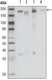 Anti-RON antibody [1B5A9] used in Western Blot (WB). GTX83174