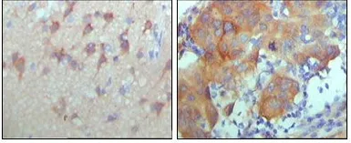 Anti-Her3 / ErbB3 antibody [3F10F6] used in IHC (Paraffin sections) (IHC-P). GTX83178