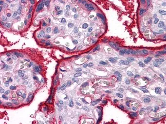 Anti-Integrin alpha 5 antibody [10F6] used in IHC (Paraffin sections) (IHC-P). GTX83192