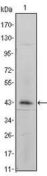 Anti-Integrin alpha 5 antibody [10F6] used in Western Blot (WB). GTX83192