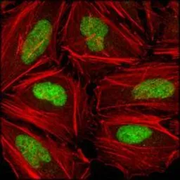 Anti-Chk2 antibody [1C12B8] used in Immunocytochemistry/ Immunofluorescence (ICC/IF). GTX83198