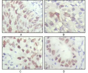 Anti-Chk2 antibody [1C12B8] used in IHC (Paraffin sections) (IHC-P). GTX83198