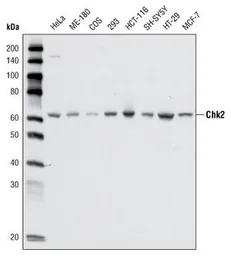 Anti-Chk2 antibody [1C12B8] used in Western Blot (WB). GTX83198