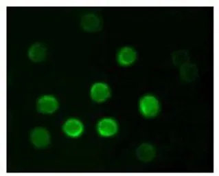 Anti-CD20 antibody [3E9D3C1G3] used in Immunocytochemistry/ Immunofluorescence (ICC/IF). GTX83206
