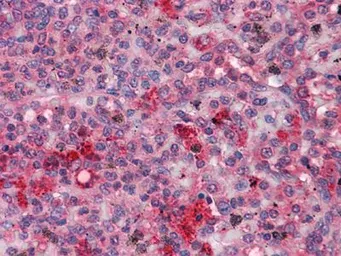 Anti-FGR antibody [6G2] used in IHC (Paraffin sections) (IHC-P). GTX83208