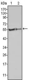 Anti-FGR antibody [6G2] used in Western Blot (WB). GTX83208