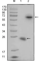 Anti-RSPO1 antibody [7A6] used in Western Blot (WB). GTX83211