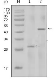 Anti-IL2 antibody [8D5] used in Western Blot (WB). GTX83212