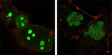 Anti-Nucleophosmin antibody [7H10B9] used in Immunocytochemistry/ Immunofluorescence (ICC/IF). GTX83217
