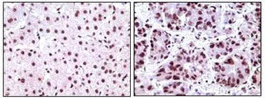 Anti-Nucleophosmin antibody [7H10B9] used in IHC (Paraffin sections) (IHC-P). GTX83217