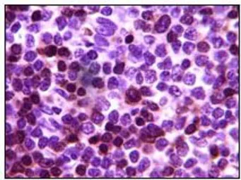 Anti-ZAP70 antibody [3D2A4] used in IHC (Paraffin sections) (IHC-P). GTX83218