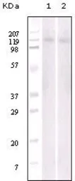 Anti-EphB6 antibody [8E7H12] used in Western Blot (WB). GTX83219