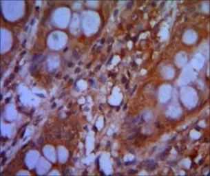 Anti-CHD3 antibody [2G4] used in IHC (Paraffin sections) (IHC-P). GTX83232