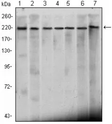 Anti-CHD3 antibody [2G4] used in Western Blot (WB). GTX83232
