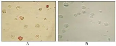 Anti-KSHV ORF45 antibody [2D4A5] used in Immunocytochemistry/ Immunofluorescence (ICC/IF). GTX83236
