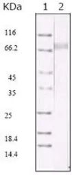Anti-KSHV ORF45 antibody [2D4A5] used in Western Blot (WB). GTX83236
