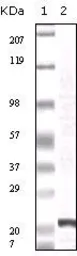 Anti-FGF2 antibody [2H5G2C11] used in Western Blot (WB). GTX83243