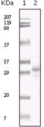 Anti-KSHV ORF26 antibody [2F6B8] used in Western Blot (WB). GTX83244