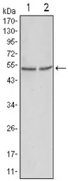 Anti-GSK3 alpha antibody [9D5G1] used in Western Blot (WB). GTX83246