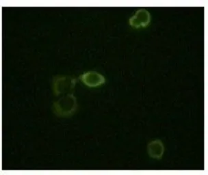 Anti-ABL2 antibody [1H1B11] used in Immunocytochemistry/ Immunofluorescence (ICC/IF). GTX83254