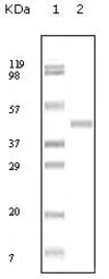 Anti-ABL2 antibody [1H1B11] used in Western Blot (WB). GTX83254