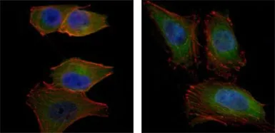 Anti-AKT2 antibody [1B6] used in Immunocytochemistry/ Immunofluorescence (ICC/IF). GTX83257