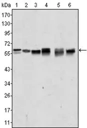 Anti-AKT2 antibody [1B6] used in Western Blot (WB). GTX83257