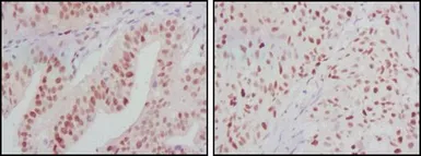 Anti-ATP2C1 antibody [4G12] used in IHC (Paraffin sections) (IHC-P). GTX83258