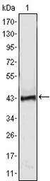 Anti-ATP2C1 antibody [4G12] used in Western Blot (WB). GTX83258