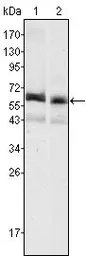 Anti-Alpha fetoprotein / AFP antibody [6E6] used in Western Blot (WB). GTX83261