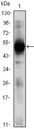 Anti-RAG2 antibody [4D5] used in Western Blot (WB). GTX83284