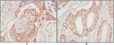 Anti-DDX4 antibody [2F9H5] used in IHC (Paraffin sections) (IHC-P). GTX83289