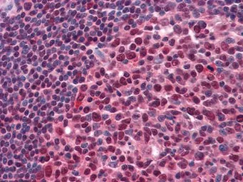 Anti-Pirh2 antibody [1H10] used in IHC (Paraffin sections) (IHC-P). GTX83290