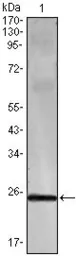 Anti-Interferon gamma antibody [3F1E3] used in Western Blot (WB). GTX83295