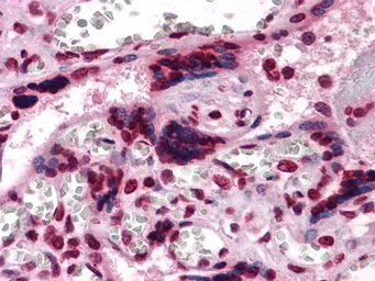 Anti-M-CSF antibody [2D10] used in IHC (Paraffin sections) (IHC-P). GTX83298
