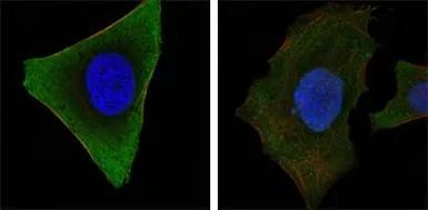 Anti-JAK3 antibody [5H2] used in Immunocytochemistry/ Immunofluorescence (ICC/IF). GTX83303