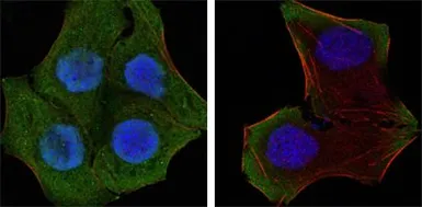 Anti-PTEN antibody [1B8] used in Immunocytochemistry/ Immunofluorescence (ICC/IF). GTX83304