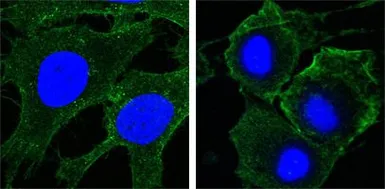 Anti-VEGF Receptor 2 antibody [4B4] used in Immunocytochemistry/ Immunofluorescence (ICC/IF). GTX83308