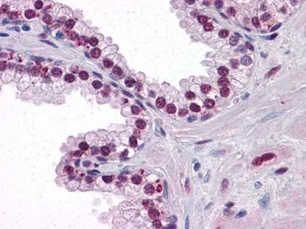 Anti-Androgen Receptor antibody [2H8] used in IHC (Paraffin sections) (IHC-P). GTX83309