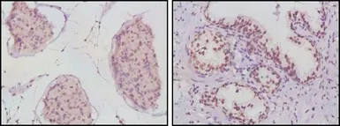 Anti-Androgen Receptor antibody [2H8] used in IHC (Paraffin sections) (IHC-P). GTX83309